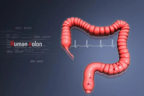 Human colon イラスト素材