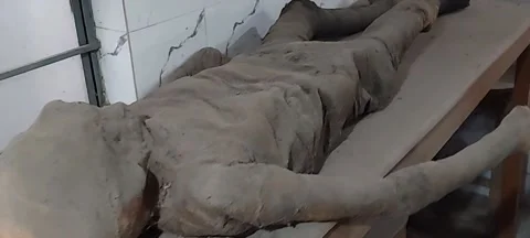 Human dead body, mummified placed on anatomy  table. Stock Footage 187085252