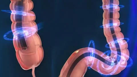 The Human Digestive System. 3D illustration of the colonoscopy Procedure Stock Illustration
