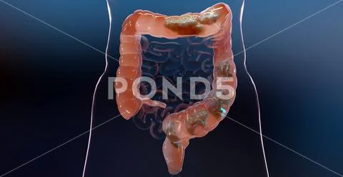 Human digestive system anatomy, concept of the intestine, laxative ...