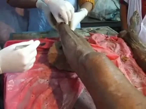 Human dissection  anatomy class. Stock Footage 184755109
