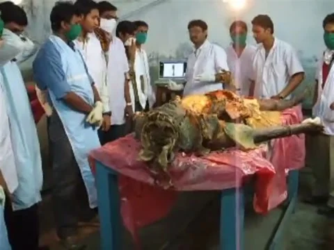 Human dissection is going on  in anatomy dissection class. Stock-Footage 184558245