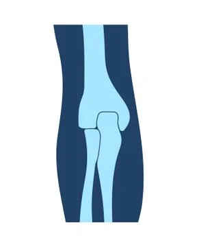 Human elbow joints, emblem or sign of medical diagnostic center or clinic, flat Stock Illustration