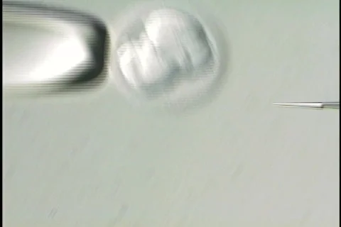 Human Embryo 01 Video stock 435275
