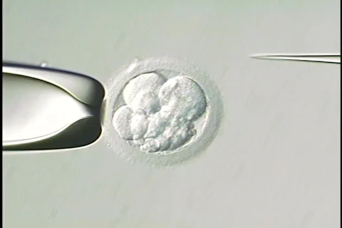 Human Embryo 02 Video stock 435284