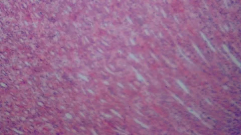 Human Excretory System Stock Footage