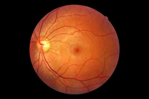 Human eye anatomy, retina, optic disc artery and vein etc. Stock Photos
