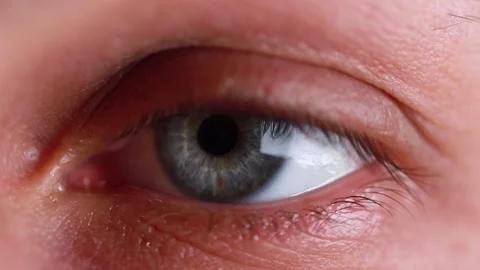 A human eye blinks in slow motion Stock-Footage 147545869