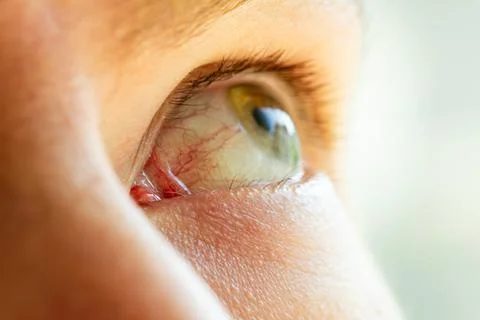 Human eye close-up with a beautiful reflection of the sky in the pupil Stock Photos