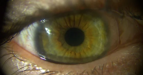 Human Eye Iris Slowmotion Extreme Close Up 스톡 동영상 86461769