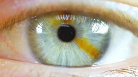 Human Eye Macro Close Up With Brown Birth Mark 스톡 동영상 70730633
