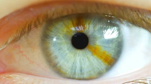 Human Eye Macro Close Up With Brown Birth Mark2 Video stock 70731942