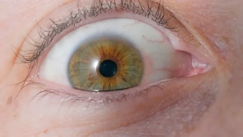 Human eye macro - optometrist asks patient to look the side, open wide, Stock Footage 236913344
