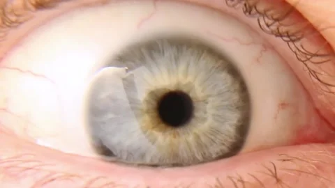 The human eye opens and the pupil decreases. The iris of the human eye. 库存影片 238024575