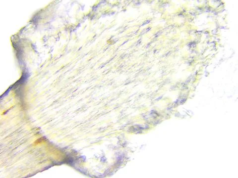 Human eyelash bulb microscopic image x400 magnification isolated on white bac Stock Photos