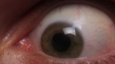 Human eyes with red veins. Potential problems with visceral health by 動画素材 183259583