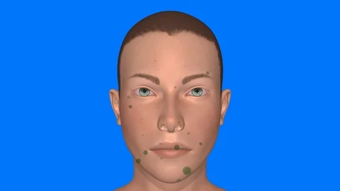 Human face covered with dirt ,  germs , bacteria , viruses. 3d animation Stock Footage 126364752