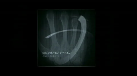 Human finger bone scan tech medical X-ray data medical research body health. Stock Footage 809522