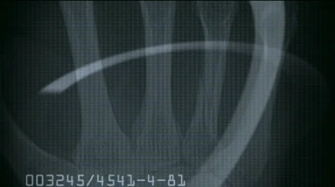 Human finger bone scan tech medical X-ray data medical research body health. Stock Footage 809626