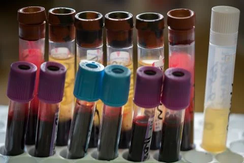 Human Fluids Stock Photos