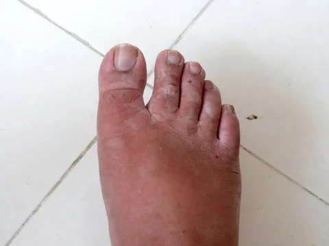 Human Foot 1 Stock Photos