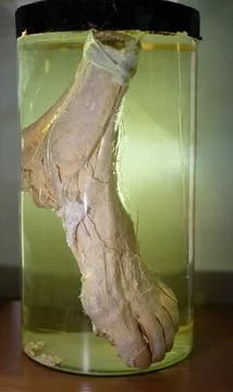 Human foot in formaldehyde solution close-up, medical research Stock Photos
