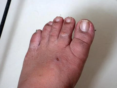 Human Foot Stock Photos