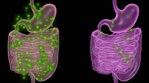Human gut microbiome healthy and unhealthy stomachs . 3d animation rendering Stock Footage