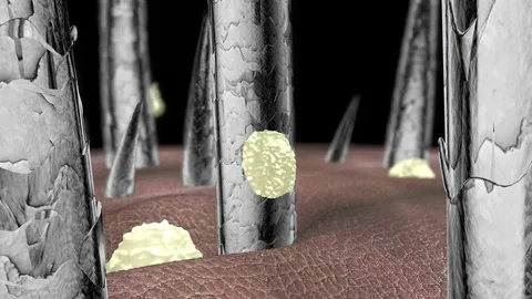 Human hair with dandruff, view to the microscope, 4K Stock Footage 103310155