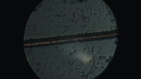 Human Hair Microscope View with Flickering Light 库存影片 319664181