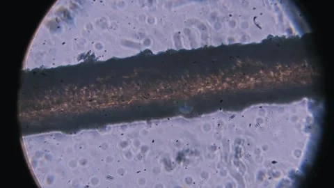 Human Hair Structure with Focus Pull Under Microscope Stock Footage 319664917