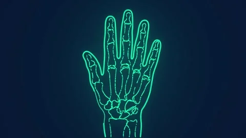 Human hand bones structure x ray examination scan anatomy medical animation Stock Footage 264960269