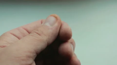 Human hand with damaged, gnawed nails and dry cuticles Stock Footage 100456112