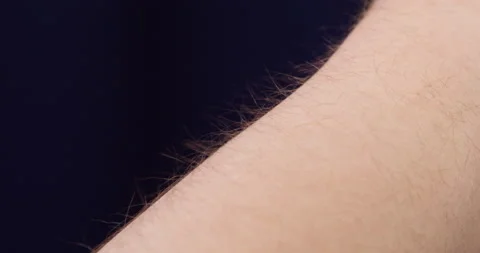 Human hand with goosebumps close-up. Texture of man arm skin on black background Stock Footage 169735326