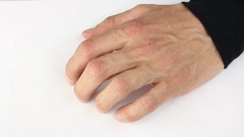 Human hand nervously scratching and tapping fingers on white table Video stock 85508927