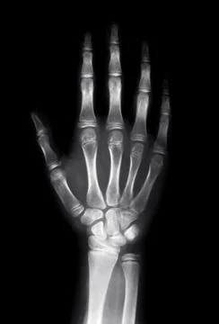 Human hand Stock Photos