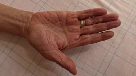 Human hand (simianline, simian lines) on the palm Stock Footage 244007787