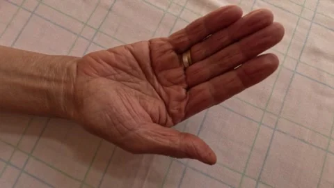 Human hand (simianline, simian lines) on the palm 動画素材 244009458