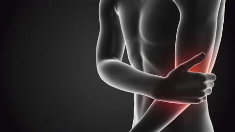 Human having pain in Arm Vídeos de archivo 168527486