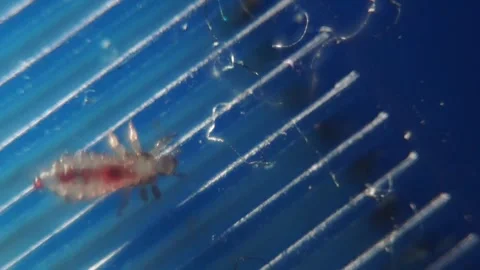 Human Head Lice Walking On Comb - Macro Shot Vidéo 324622335