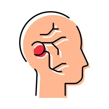 Human head showing brain aneurysm with blood vessels Stock Illustration