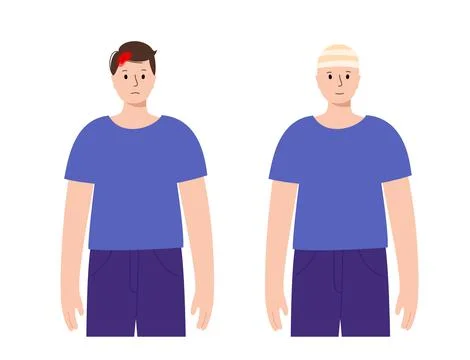 Human head trauma Stock Illustration