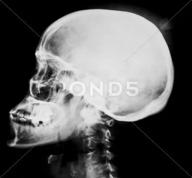 Human head x-ray film Stock Photos