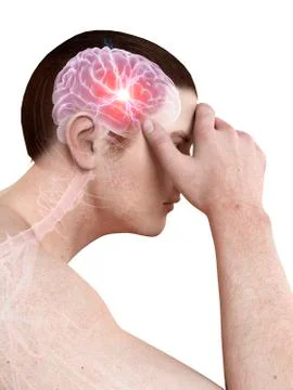 Human headache, illustration Stock Illustration