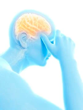 Human headache, illustration イラスト素材