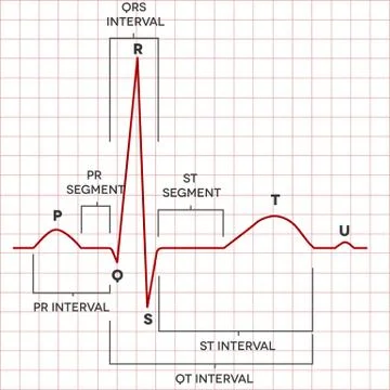 Human heart normal sinus rhythm, electrocardiogram Stock Illustration