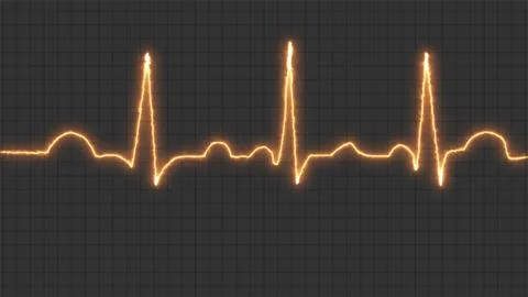 Human heart normal sinus rhythm electrocardiogram. ECG. EKG. Vital sign. Me.. イラスト素材