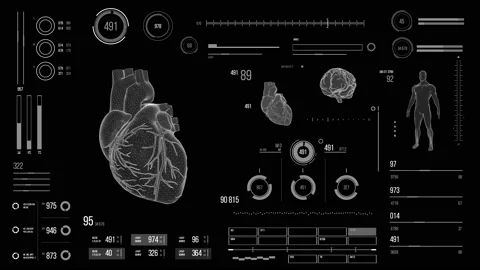 Human heart scan. Stock Footage 118877202