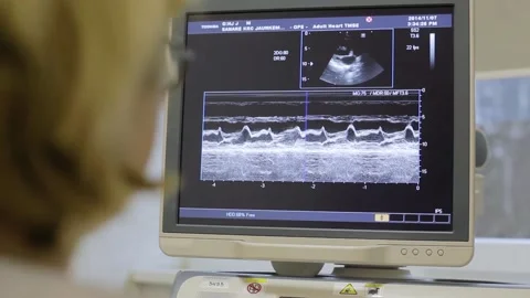 Human heart test Stockbeeldmateriaal 168649891