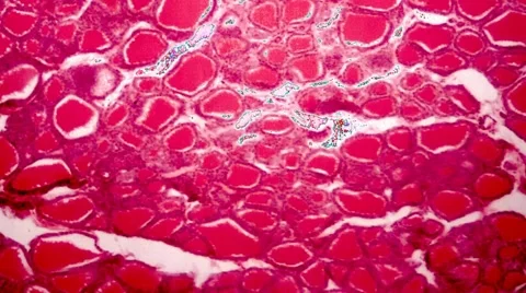 Human Hemopoietic Tissue Stock Footage 6531567